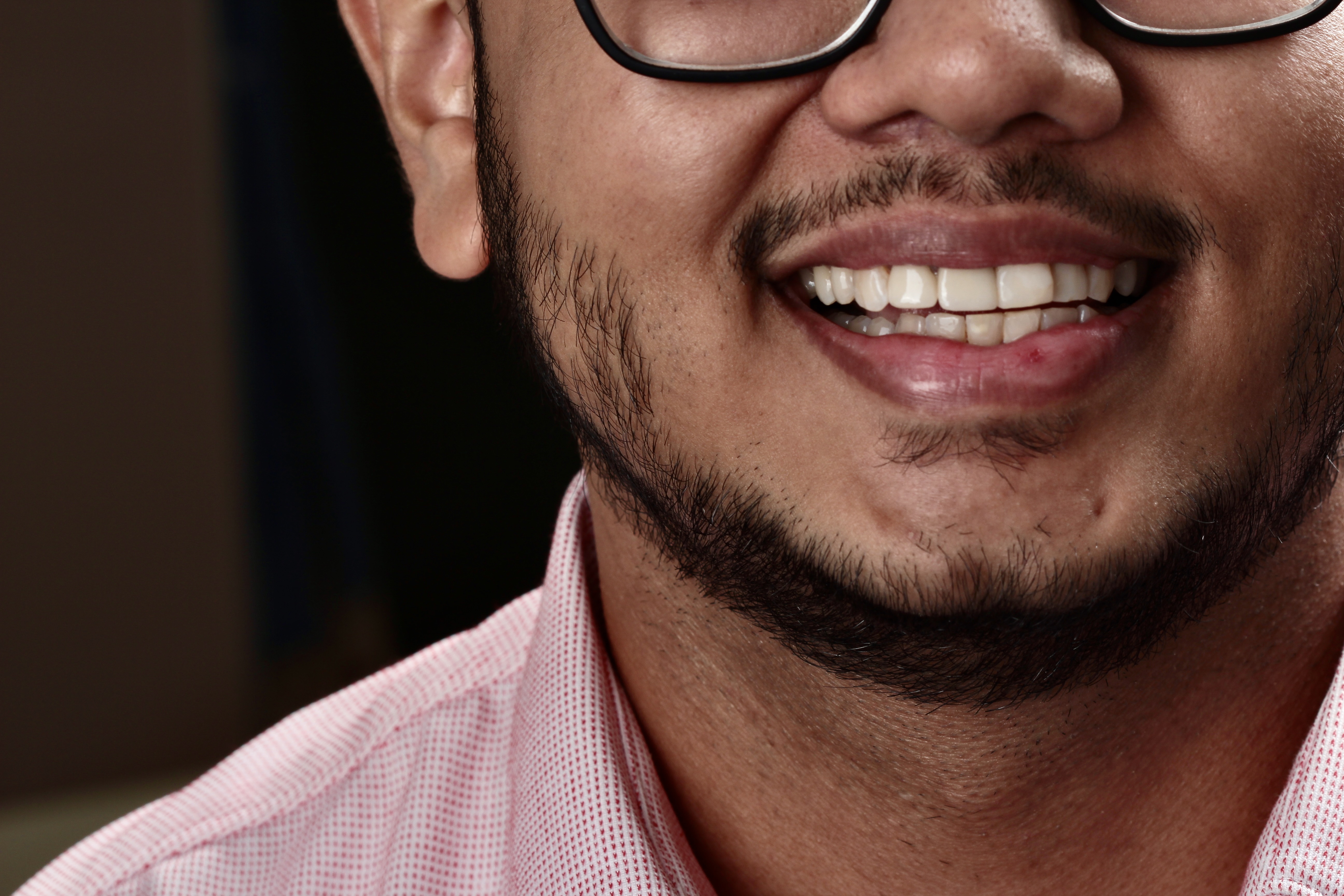 Ant Discoloured Teeth
